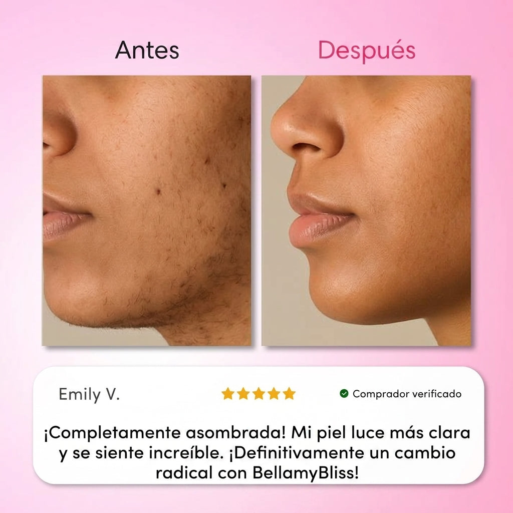 Kit Trilogía de Depilación BellamyBliss