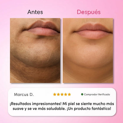 Kit Trilogía de Depilación BellamyBliss