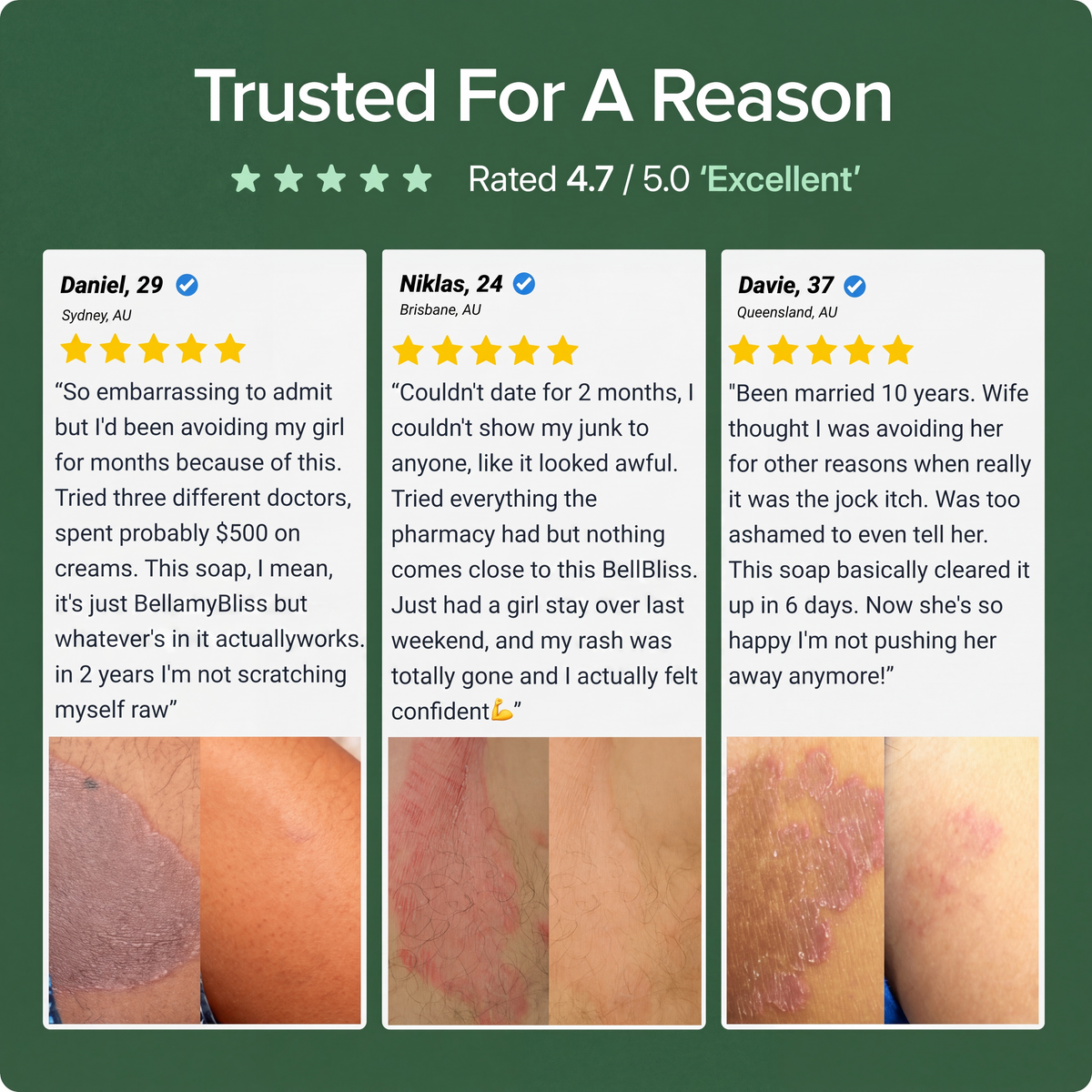 BellamyBliss™ Antifungal Soap